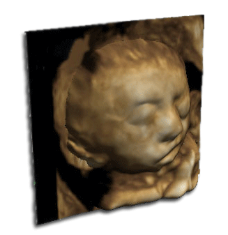 3d ultrasound scan sculpture
